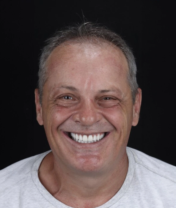 gadgag